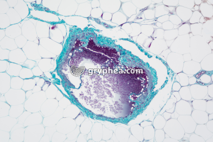 Veine x25 - gryphea.com